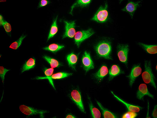 Immunostaining of HeLa cells showing strong nuclear lamina staining with anti-Lamin A/C (cat. 1027-LAM, red, 1:1000) and anti-Vimentin (cat. 2105-VIM, green, 1:500).
