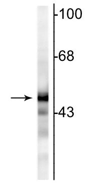 Western blot of rat cortical lysate showing specific immunolabeling of the ~47 kDa NSE protein.