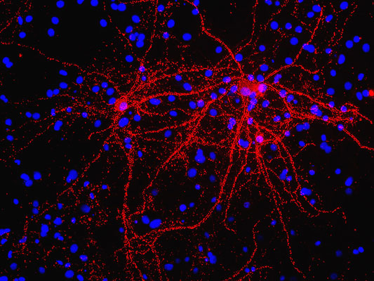 Immunostaining of 40DIV cultured rat cortical neurons showing punctate distribution of synapsin (cat. 1925-SYNP, 1:1000, red). The blue is staining nuclear DNA. Cells and photo courtesy of QBMCellScience.