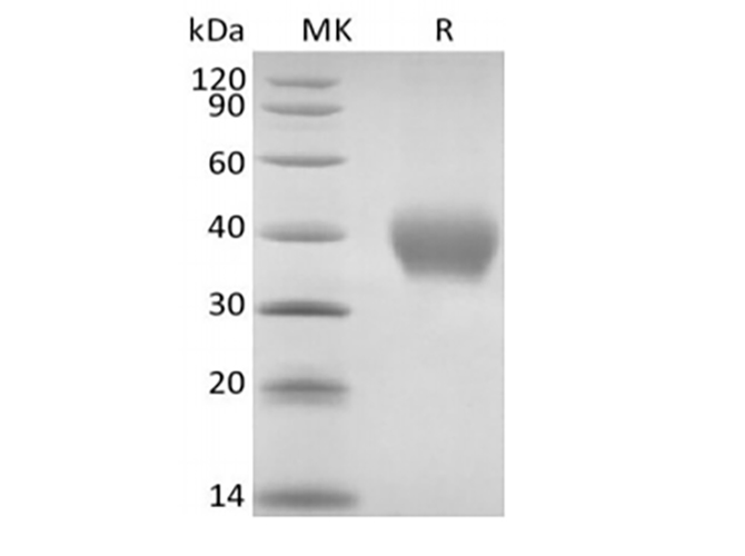 Recombinant Rhesus Macaque TNF Receptor II/TNF RII/TNFRSF1B/CD120b (C-6His) - small - 1
