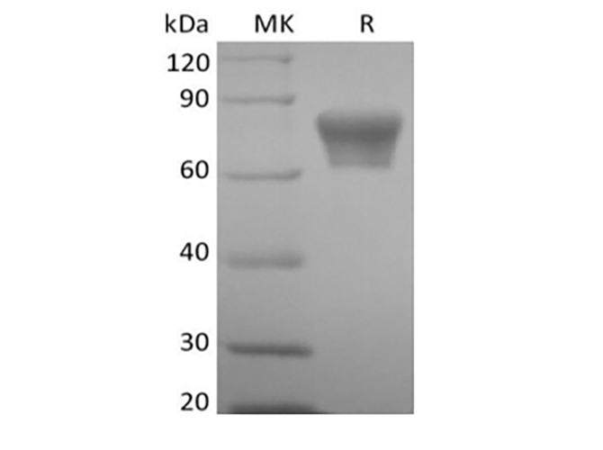 Recombinant Mouse TNF Receptor II/TNF RII/TNFRSF1B/CD120b (C-Fc) - small - 1