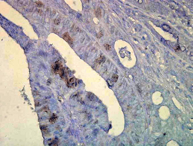Anti-HSP70 Monoclonal Antibody (Clone : C92F3A-5) - RPE