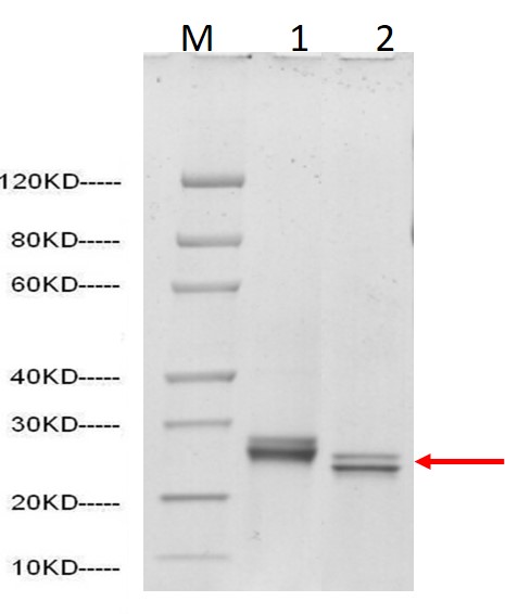 SARS-CoV-2 Spike protein (RBD, C- Term His Tag) (Sf9 cell line)