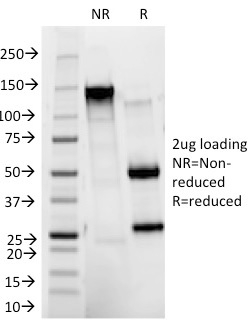 SDS-PAGE Analysis of Purified CD11b Mouse Monoclonal Antibody (ITGAM/271). Confirmation of Integrity and Purity of Antibody.