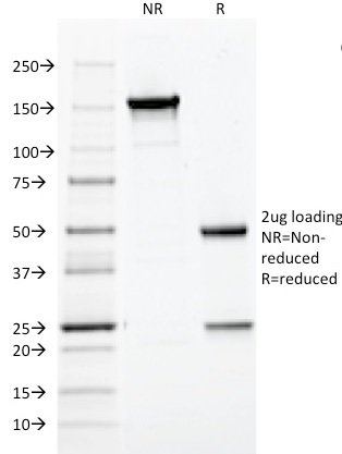 SDS-PAGE Analysis of Purified HPV-16 Monoclonal Antibody (CAMVIR-1). Confirmation of Purity and Integrity of Antibody.