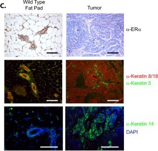 NOTCH1 inhibition in vivo results in mammary tumor regression and reduced mammary tumorsphere-forming activity in vitro.