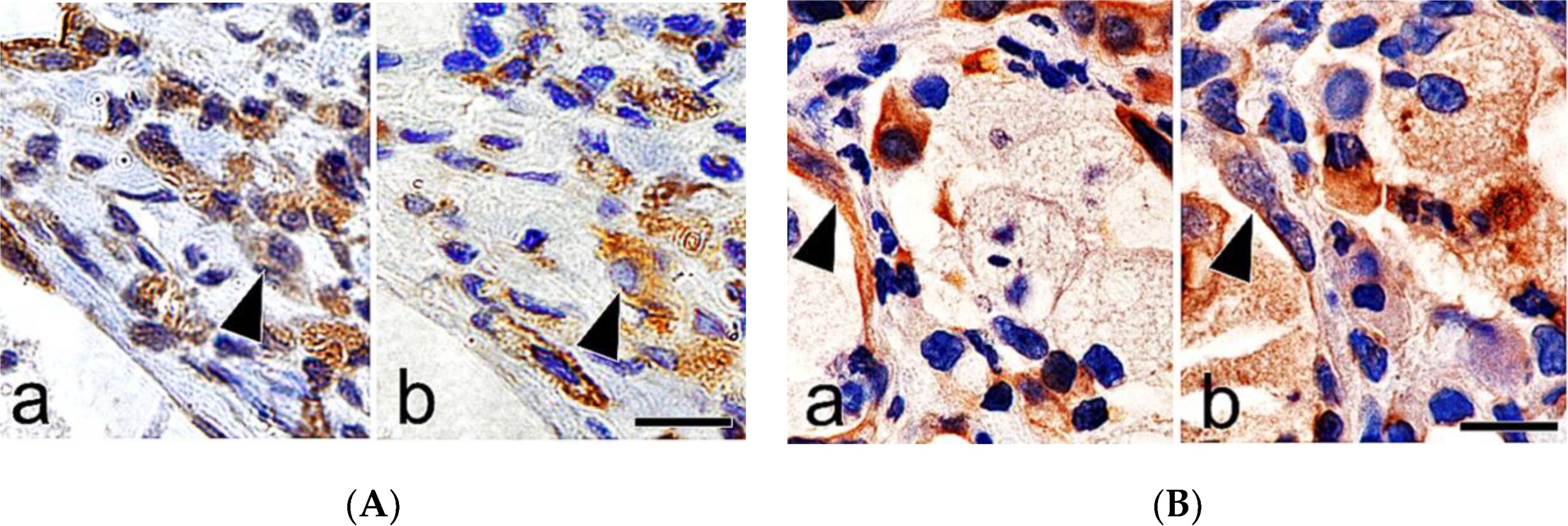 Pathological Study on Epithelial-Mesenchymal Transition in Silicotic Lung Lesions in Rat.