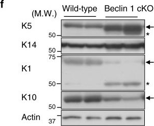 Beclin 1 regulates recycling endosome and is required for skin development in mice.