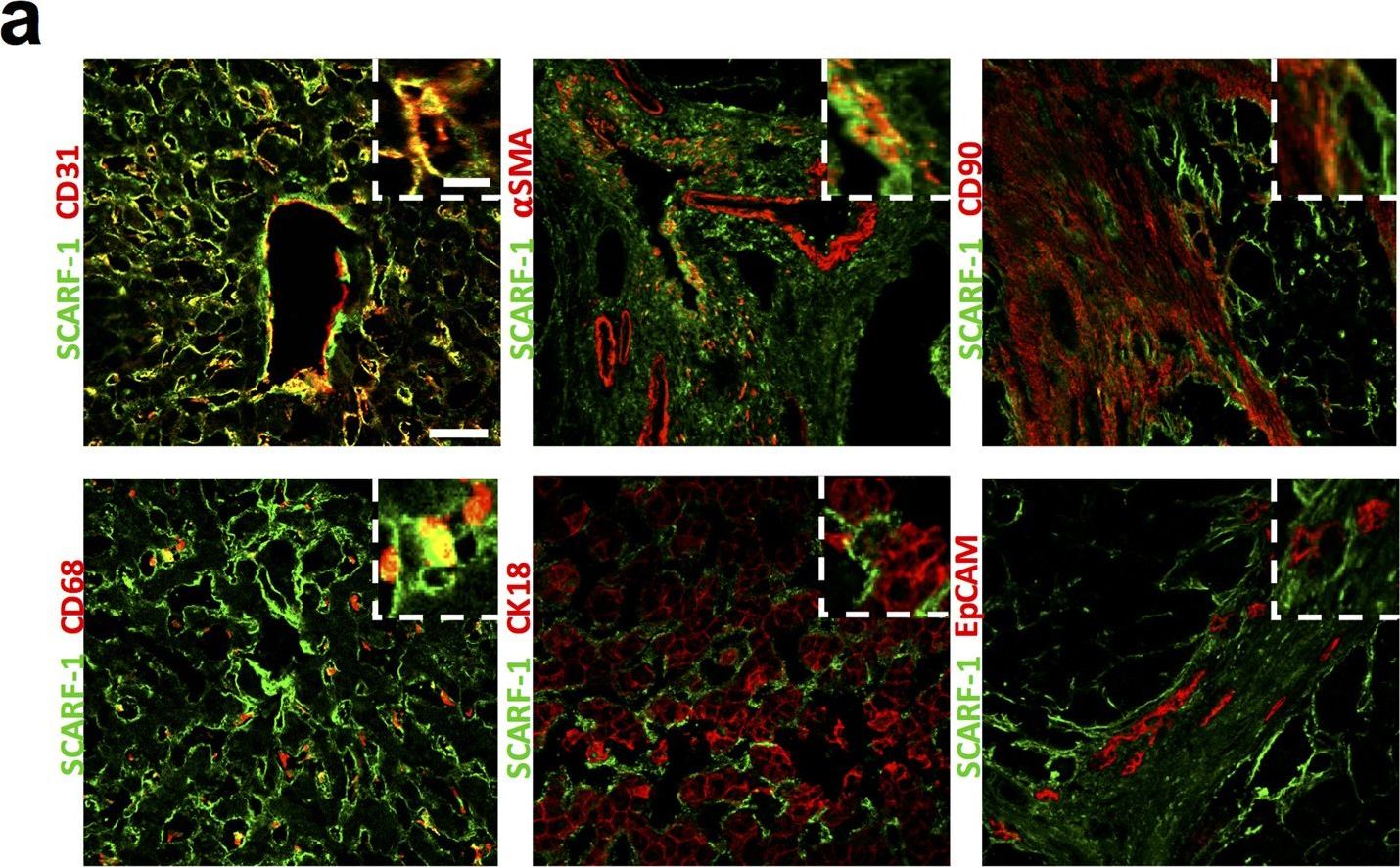 SCARF-1 promotes adhesion of CD4+ T cells to human hepatic sinusoidal endothelium under conditions of shear stress.