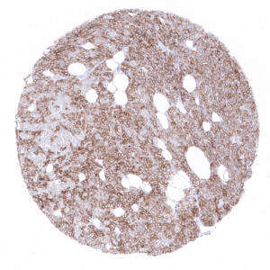 A moderate to strong membranous CD4 positivity is seen in all epithelial cells of the parathyroid gland.