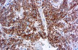 Anti-CD117 / c-kit CE/IVD for IHC - Gastrointestinal pathology