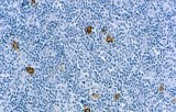 Anti-CD15 CE/IVD for IHC - Hematopathology