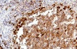 Anti-CD38 CE/IVD for IHC - Hematopathology