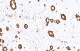 Anti-CD44 CE/IVD for IHC - Genitourinary pathology