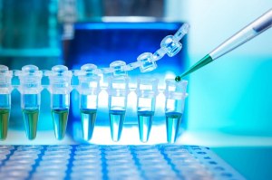 qPCR for diagnostic