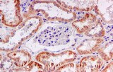 Immunohistochemistry (IHC)