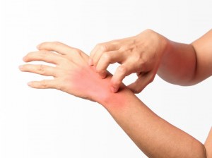 Key Tools for Allergy Research: Antibodies, ELISA Kits, Proteins ...
