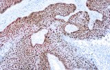 Anti-p63 CE/IVD for IHC - Dermopathology